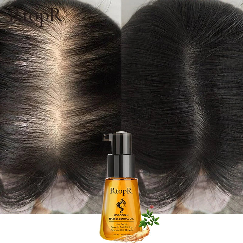 Moroccan Prevent Hair Loss Product  Hair Growth Essential Oil Easy To Carry Hair Care Nursing 35ml Both male and female can use